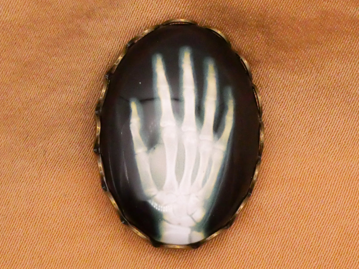 Hand X-Ray Oval Glass Bronze Lace Metal Button 19x26mm