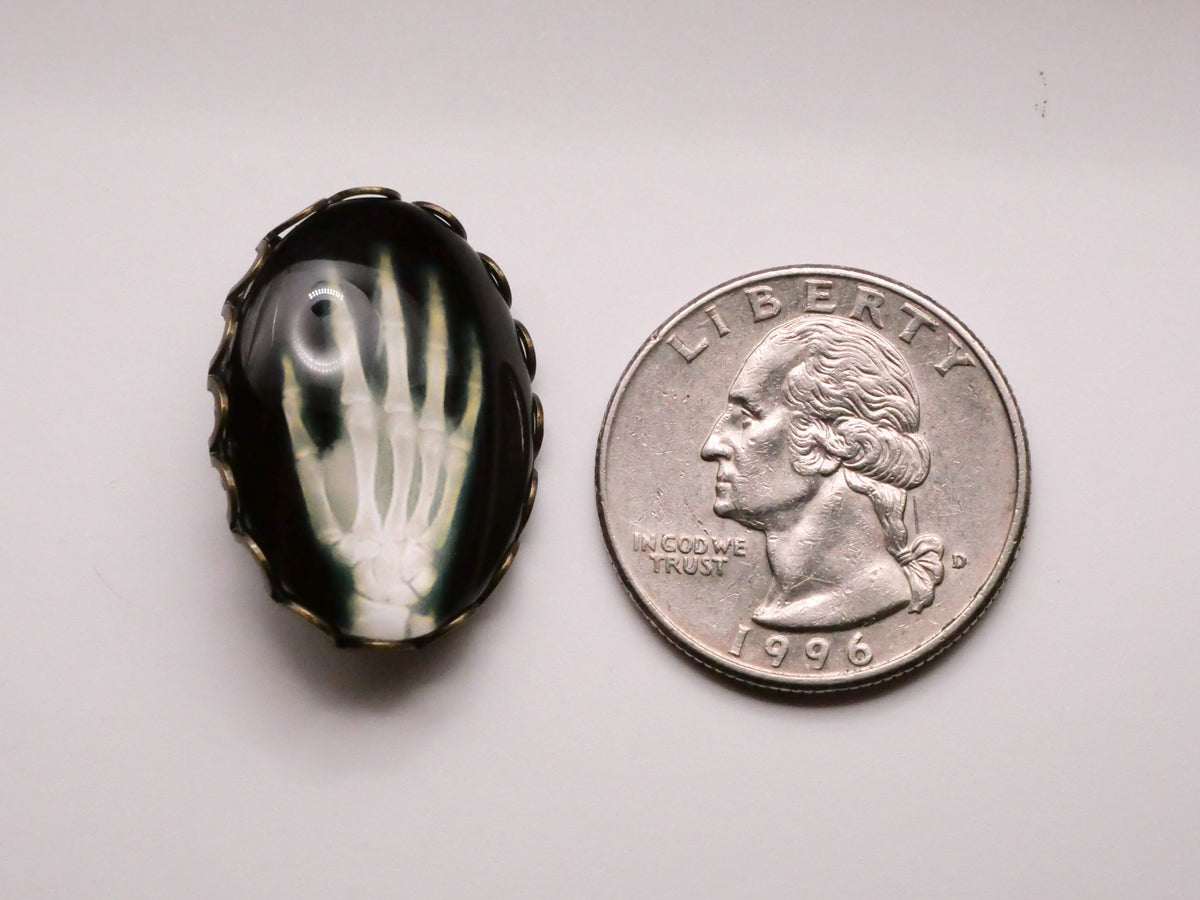 Hand X-Ray Oval Glass Bronze Lace Metal Button 19x26mm